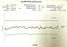 NIB SOLARTRON 971287-1 DT20P FEATHER TOUCH PNEUMATIC DIGITAL PROBE 20MM STROKE